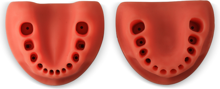 Replacement Gingiva